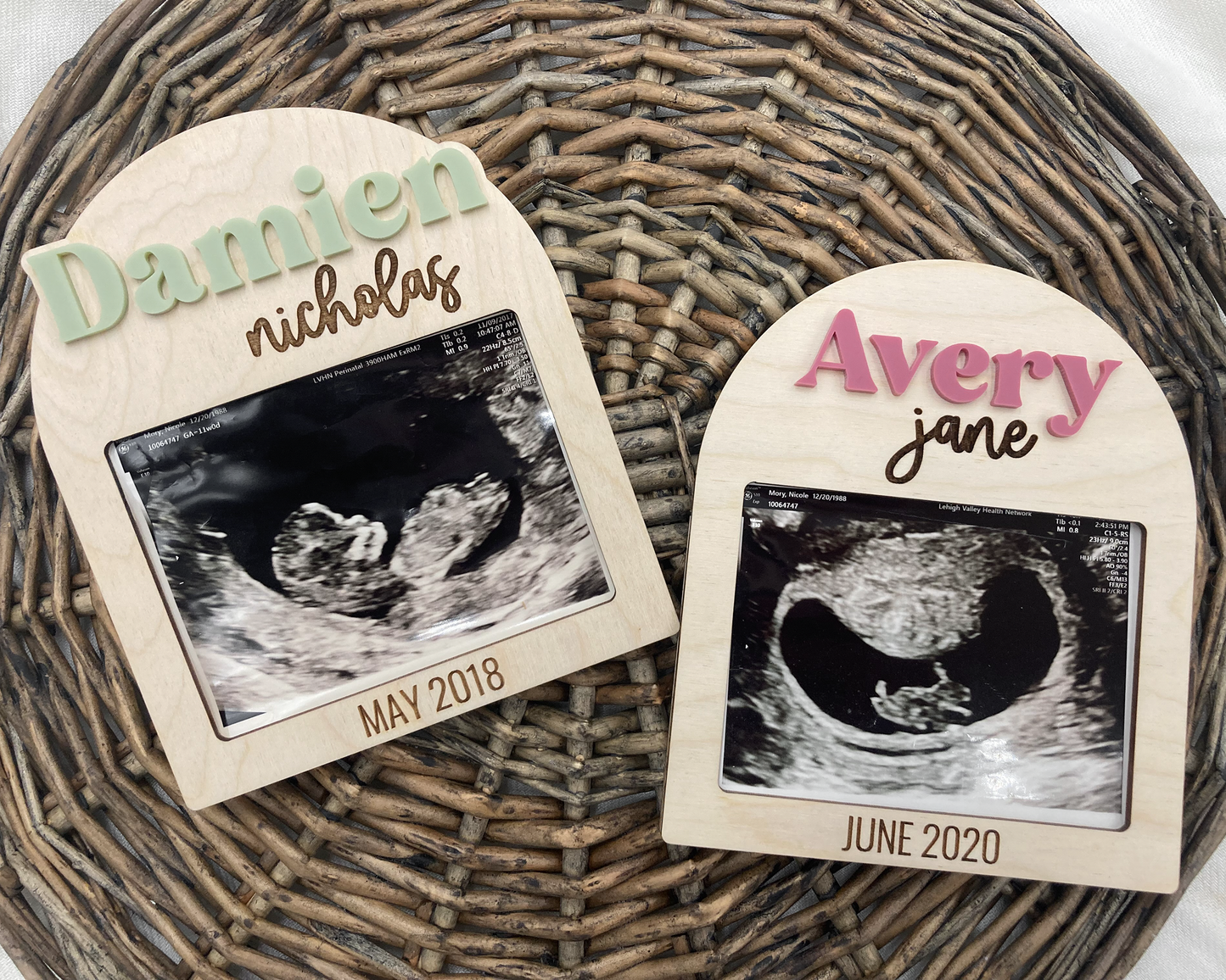 Personalized Magnetic Ultrasound Picture Frame